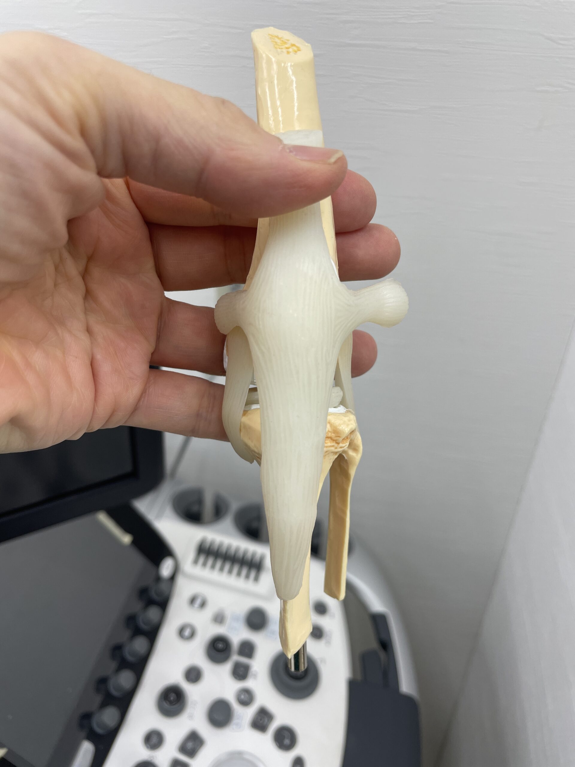 05正常正面から