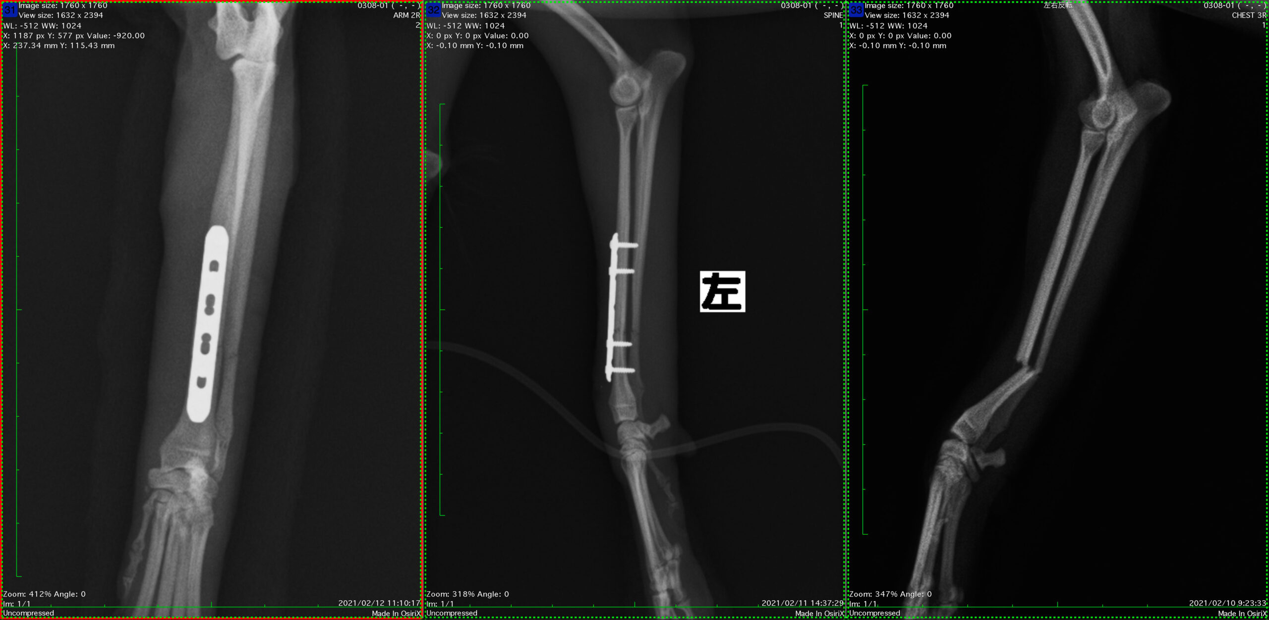 1.手術食前食後