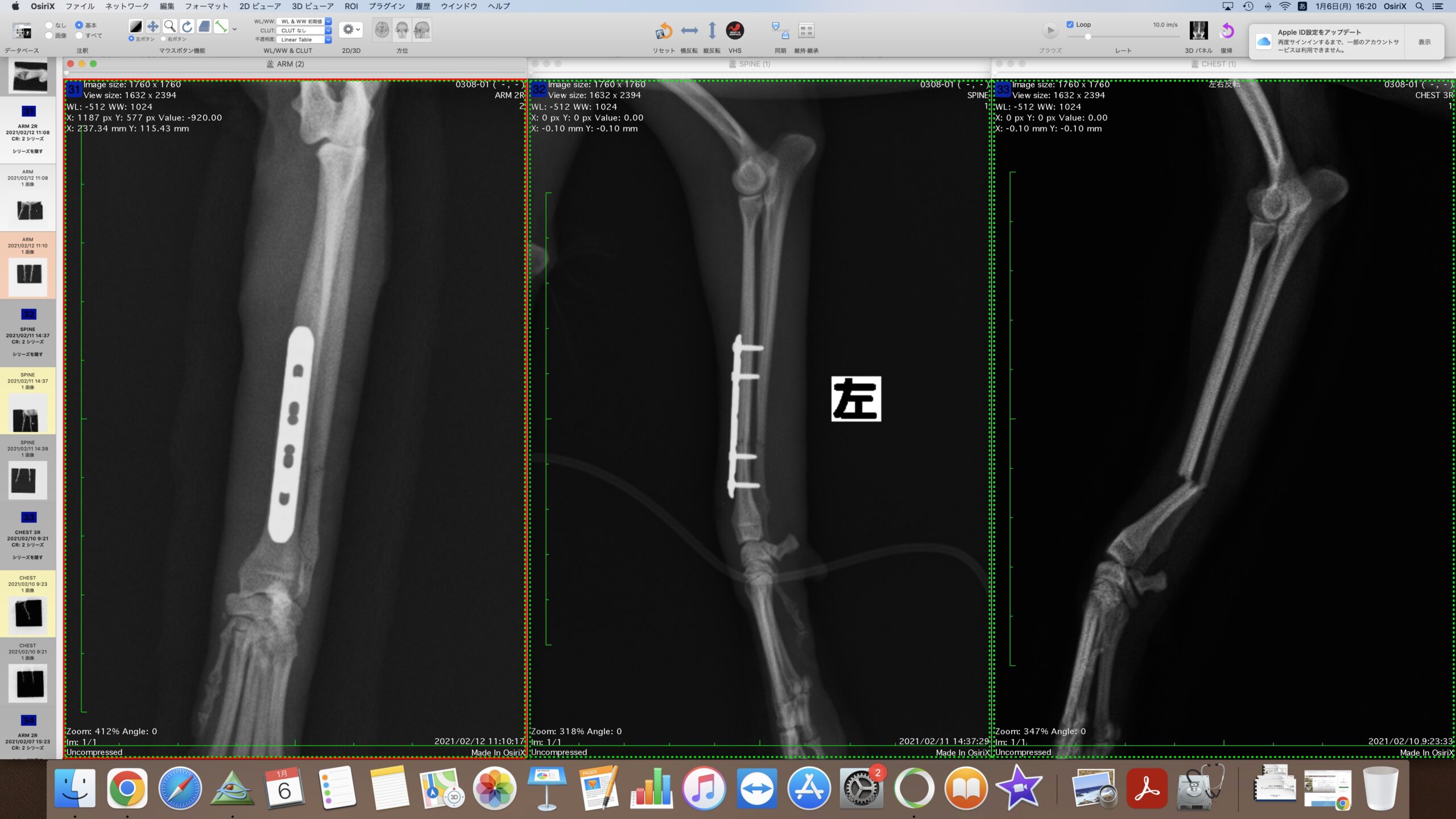 1、手術食前食後